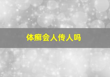 体癣会人传人吗