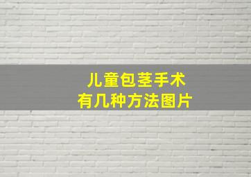 儿童包茎手术有几种方法图片