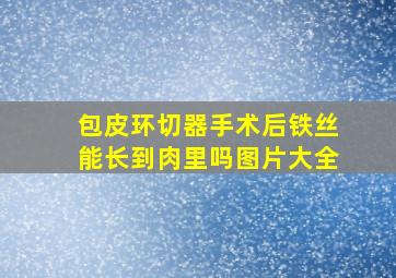 包皮环切器手术后铁丝能长到肉里吗图片大全