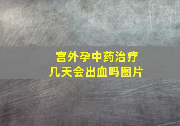 宫外孕中药治疗几天会出血吗图片