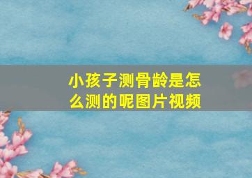 小孩子测骨龄是怎么测的呢图片视频