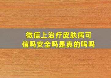 微信上治疗皮肤病可信吗安全吗是真的吗吗