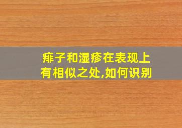 痱子和湿疹在表现上有相似之处,如何识别