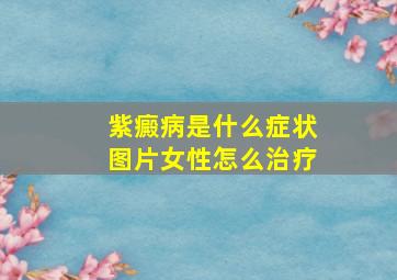 紫癜病是什么症状图片女性怎么治疗