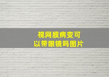 视网膜病变可以带眼镜吗图片